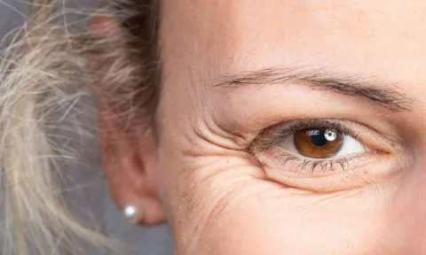 4 giải pháp làm chậm lão hoá, giúp trẻ lâu ai cũng có thể thực hiện