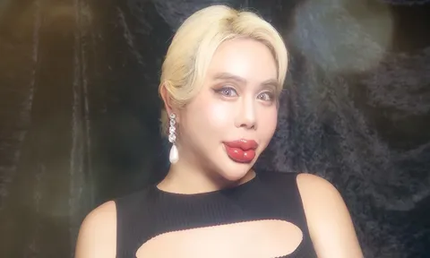 Bị miệt thị ngoại hình, chàng trai Nhật chi bộn tiền phẫu thuật thẩm mỹ