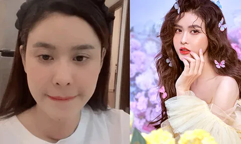 Trương Quỳnh Anh xác nhận vừa phẫu thuật tuyến giáp, hé lộ tình trạng hiện tại