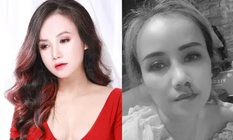 Điều tra vụ diễn viên Hoàng Yến phim "Về nhà đi con" bị chồng cũ hành hung