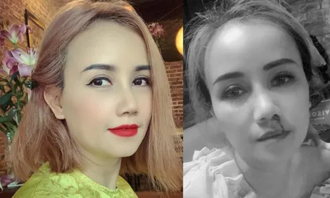 Diễn viên Hoàng Yến bị chồng cũ 'đấm vỡ mũi'